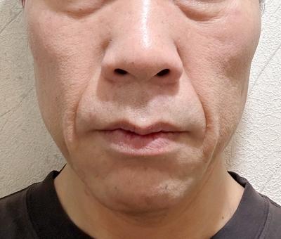 VOICE2 BEFORE / AFTER CASE3 心強いパートナーを手に入れた