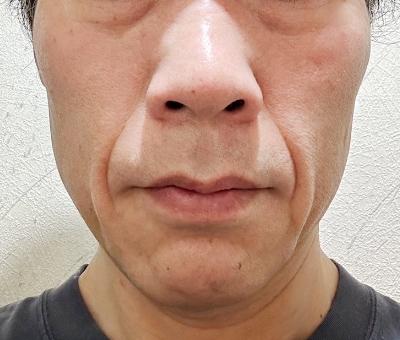 VOICE2 BEFORE / AFTER CASE3 心強いパートナーを手に入れた