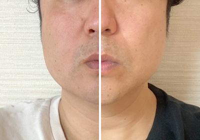 STEP:4 アフターお客様サポート